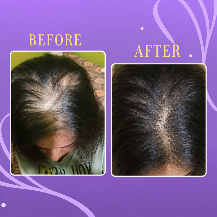 Scalp Nurture Hair Serum Duo