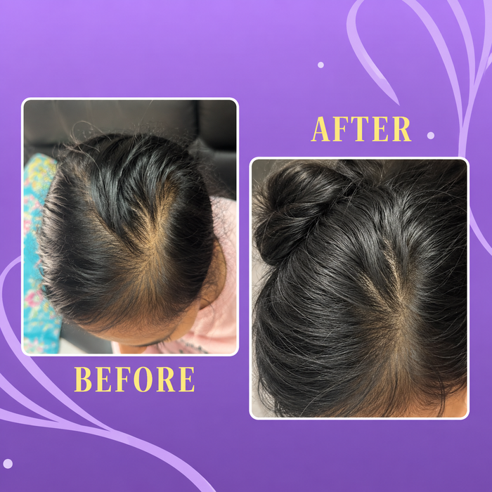 Scalp Nurture Hair Serum
